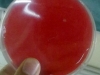 blood-agar-3