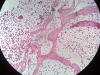 Spongy Bone