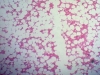 Spongy Bone