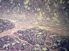 Elastic Cartilage