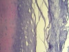 Fibro Cartilage