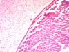 Hyaline Cartilage