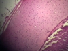 Hyaline Cartilage