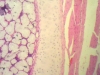 Hyaline Cartilage