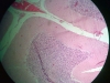 cerebellum-1