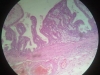 chronic-inflammation-4