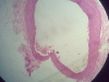 Artery