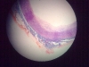 Vein
