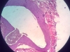 Vein