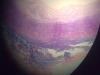Vein