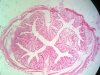 colon-3