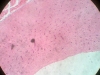 compact-bone-3
