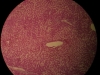 liver-congestion-10x