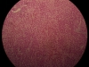 liver-congestion-10x