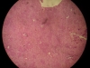 liver-congestion-4x