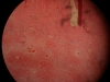 lungs-congestion-4x