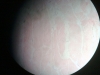 Dense regular connective tissue -2