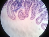Duodenum-2