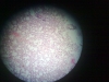 Simple sqamous epithelium