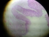 esophageal-stomach-junction-2