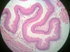 esophagus-2