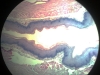 esophagus-4