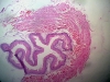 esophagus-5