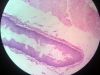 esophagus-6