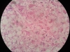 fatty liver-40x
