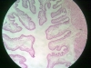 gall-bladder-1