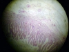 gall-bladder-2