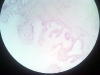 gall-bladder-3
