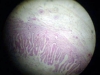 gall-bladder-4