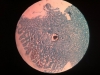 Chronic gastritis-giemsa-10x