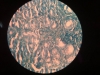 Chronic gastritis-giemsa-40x