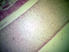 hyaline-cartilage-1