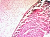 Hyaline cartilage -5