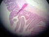 ileum-2