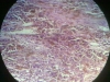 melanin-1