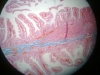 jejunum-1