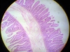 jejunum-4