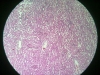 kidney-1