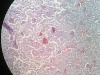 kidney-3