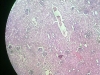 kidney-4