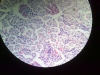 kidney-5