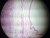 larynx-1