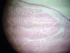 larynx-2