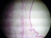 larynx-3