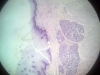 Lip -2
