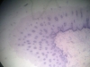Lip -6